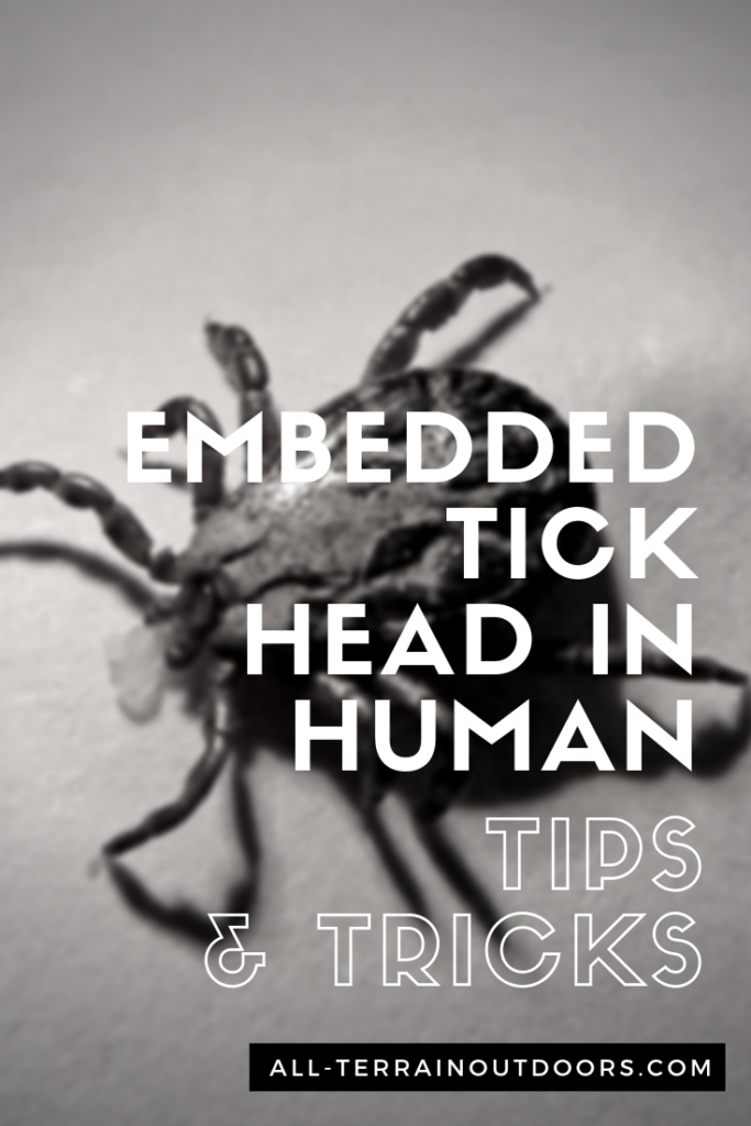 embedded tick head in human